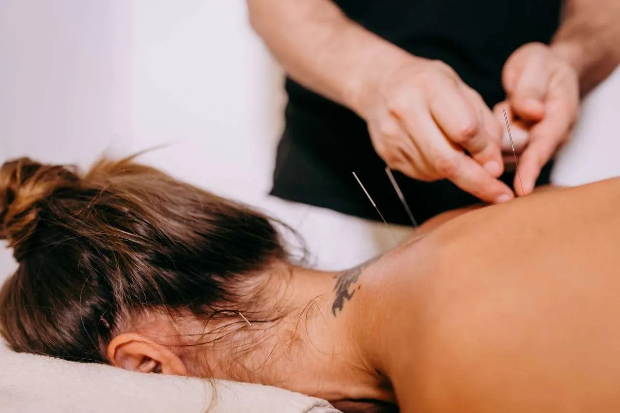A woman with a neck tat getting acupuncture.