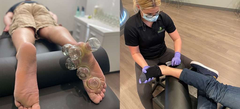 RxWellness providers performing cupping and shockwave therapy on a patient's foot and ankle to treat shin splints and plantar fasciitis
