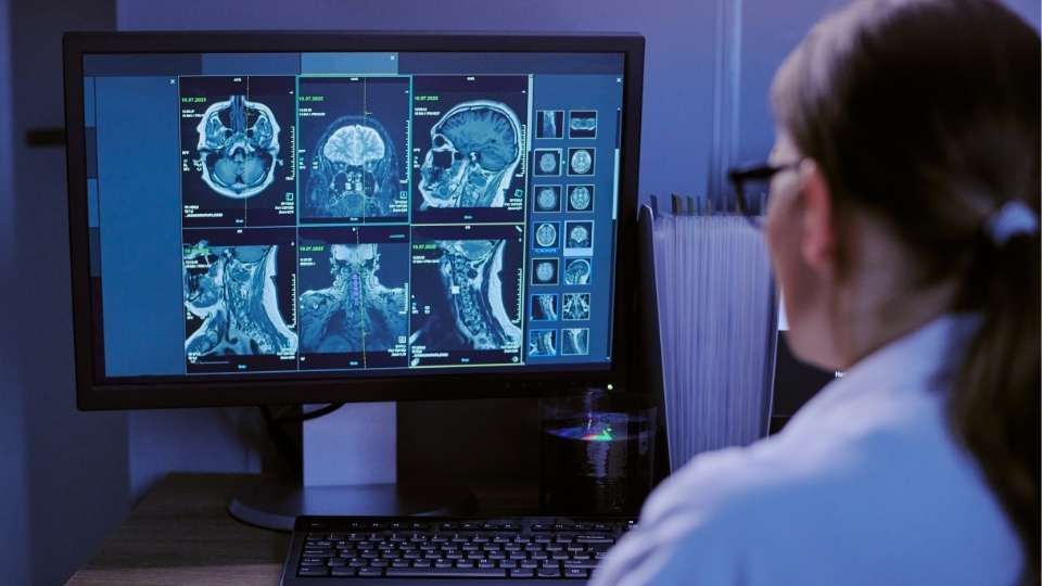 Doctor in a white coat reviewing cervical spine and brain MRI scans on a computer monitor in a dimly lit medical office