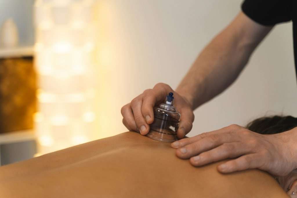 An image of a practitioner performing cupping in Ashburn.