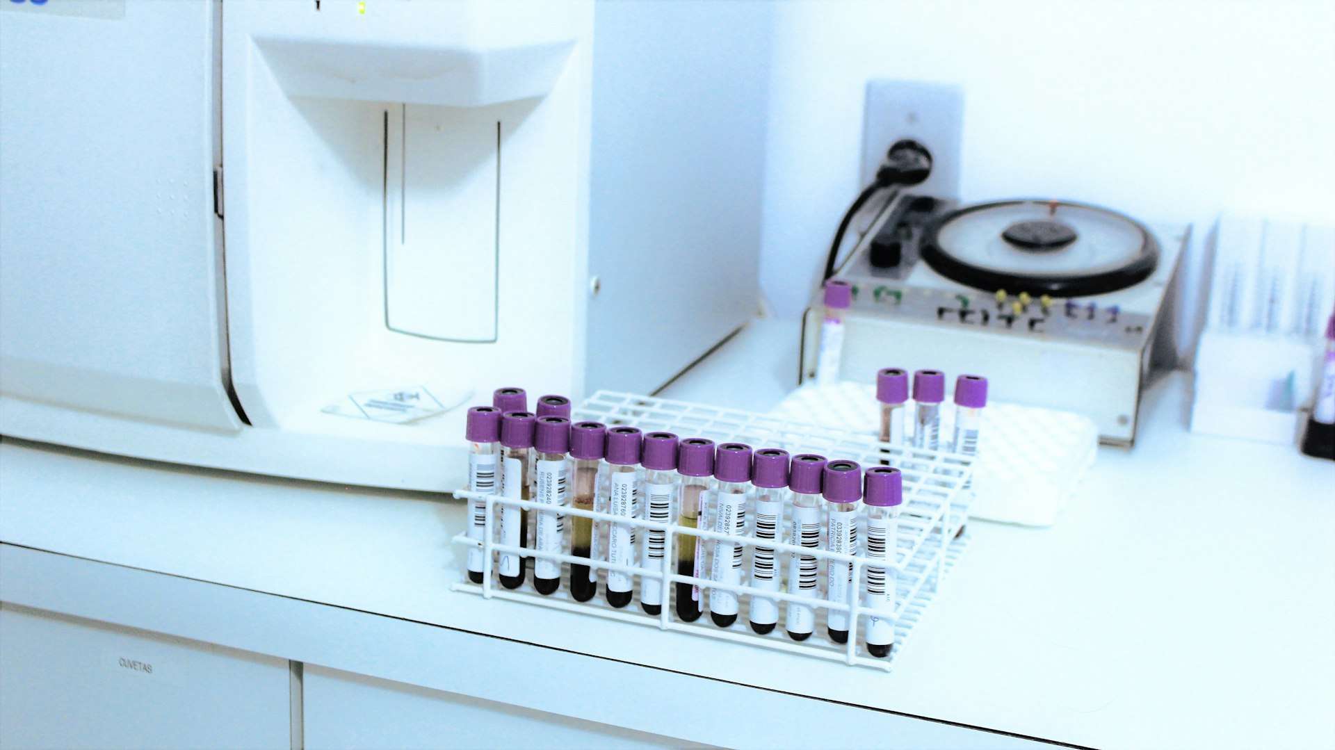 Rows of purple-capped blood sample tubes beside lab equipment, the first step in many regenerative medicine injections.