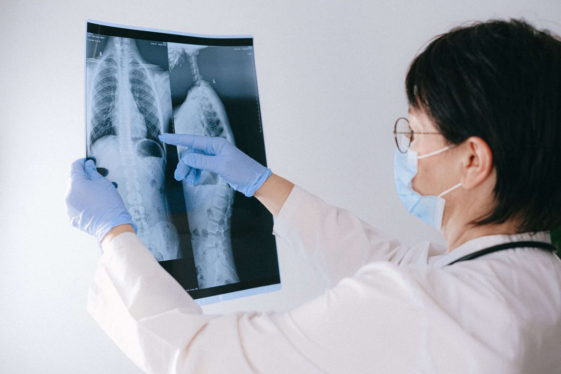 Physician in a mask and glasses points to a chest and spine X-ray film, checking imaging before deciding on next steps.